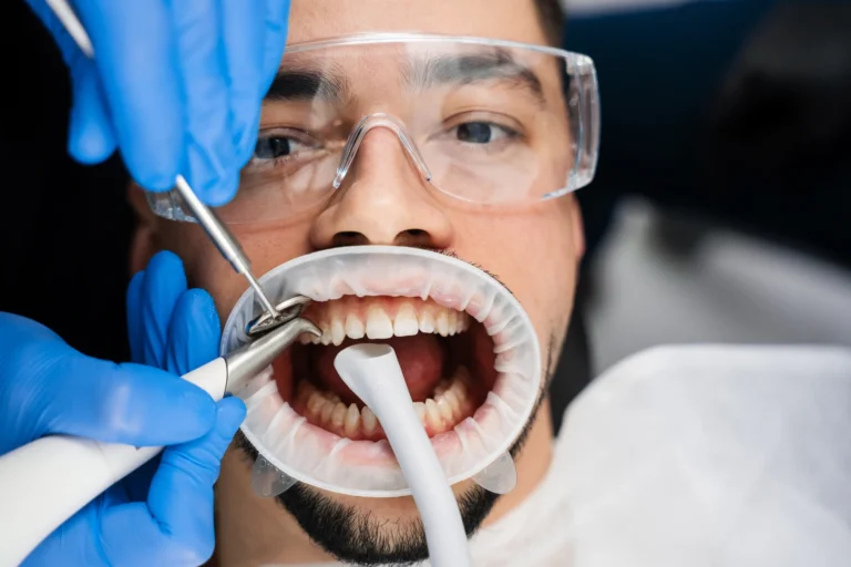 Blog 3 Guided Biofilm Therapy
